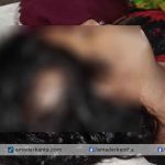 মঠবাড়িয়ায় সন্তানের জননীকে কুপিয়ে জখমের ঘটনায় মামলা
