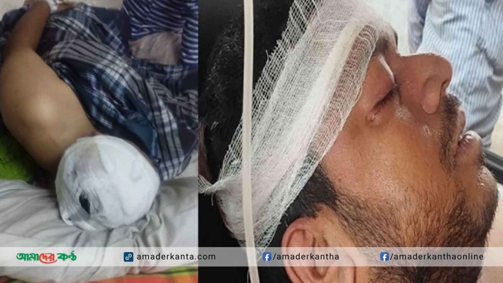 বোয়ালমারীতে জমি সংক্রান্ত বিরোধের ঘটনায় মামলা হওয়া সত্ত্বেও আসামি গ্রেপ্তারে গড়িমসি পুলিশের