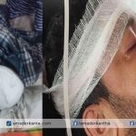 বোয়ালমারীতে জমি সংক্রান্ত বিরোধের ঘটনায় মামলা হওয়া সত্ত্বেও আসামি গ্রেপ্তারে গড়িমসি পুলিশের